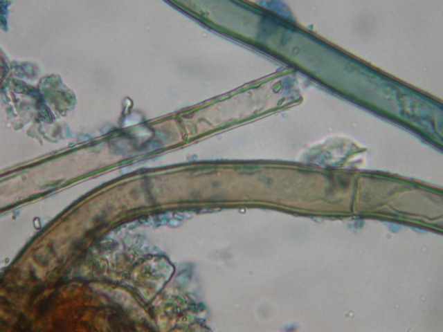 Geopora sumneriana ... in MICRO